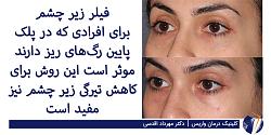 قبل و بعد از درمان انواع واریس در کلینیک دکتر مهرداد اقدسی بهترین متخصص واریس